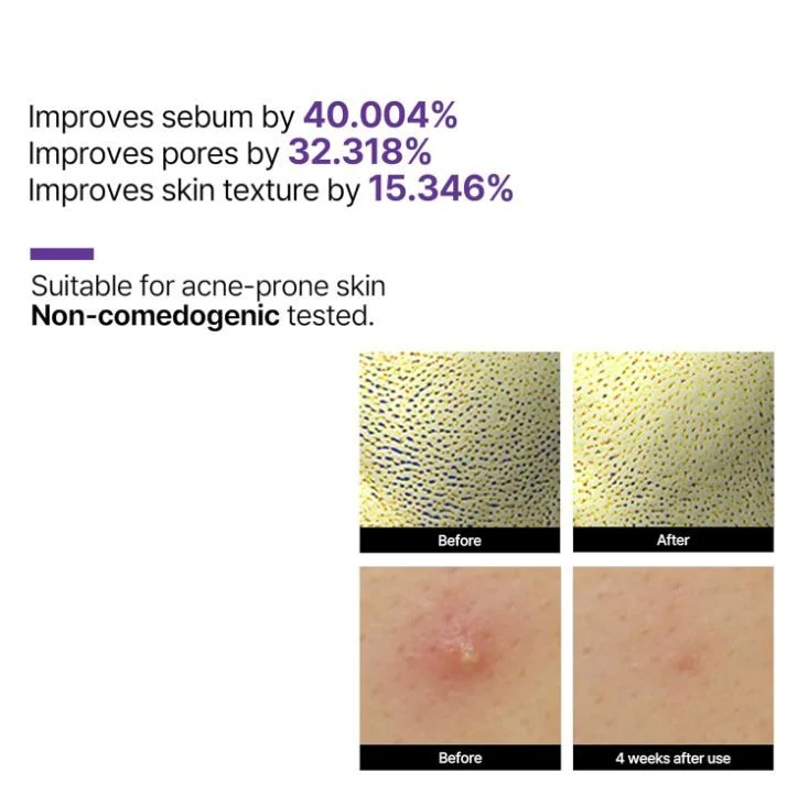 SOME BY MI Retinol Intense Reactivating Serum - 30ml(1.01oz)