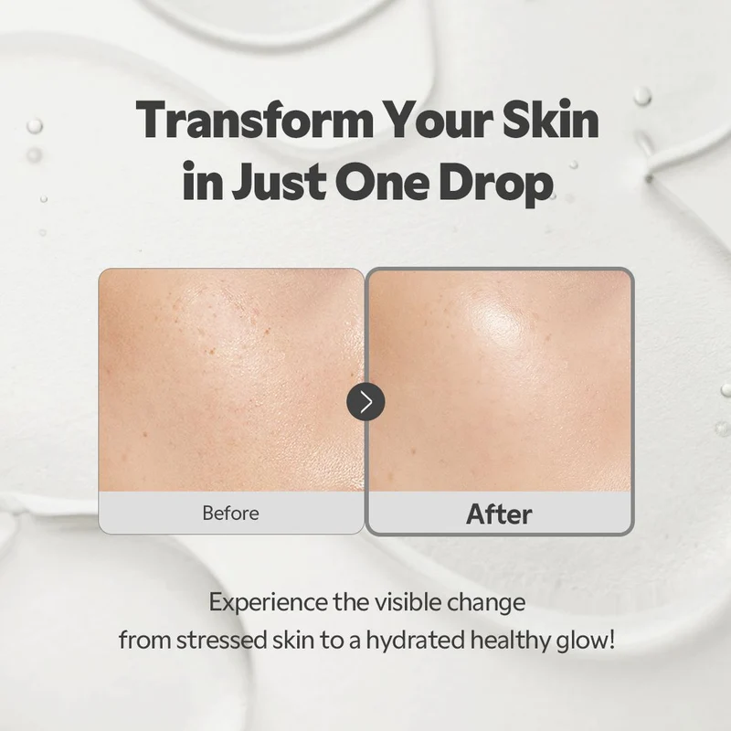 TIRTIR SOS Serum 50ml