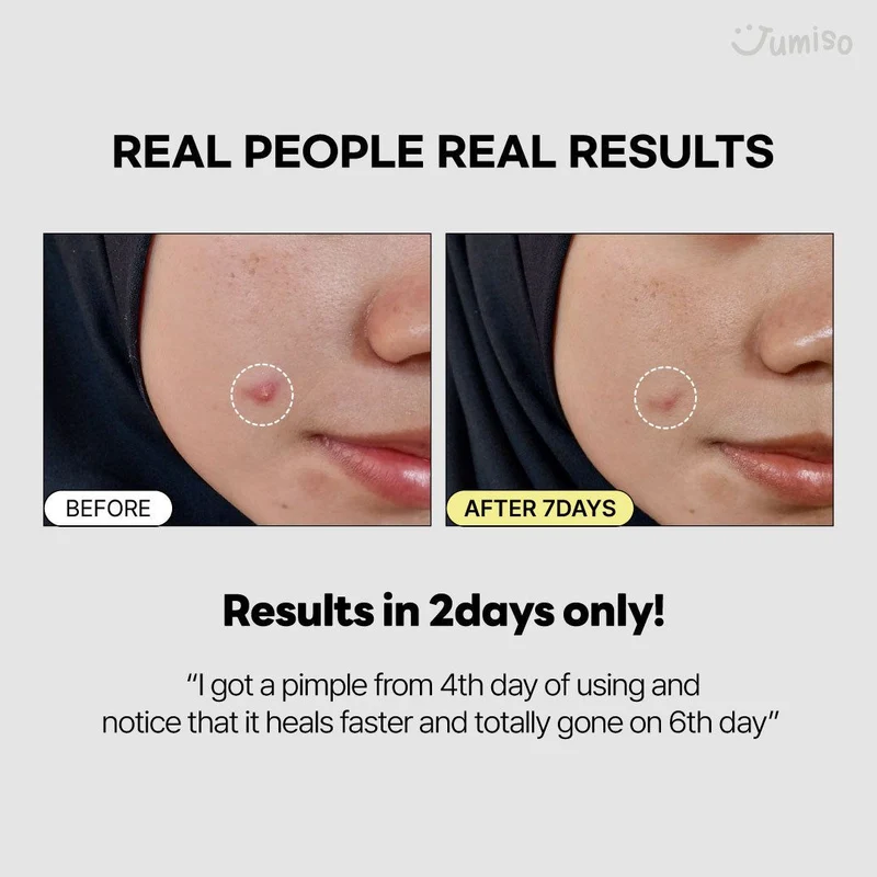 Jumiso Snail Mucin 95% + Peptide Essence 140ml
