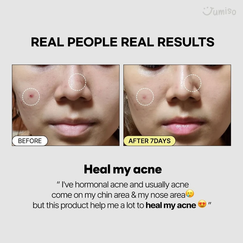 Jumiso Snail Mucin 95% + Peptide Essence 140ml