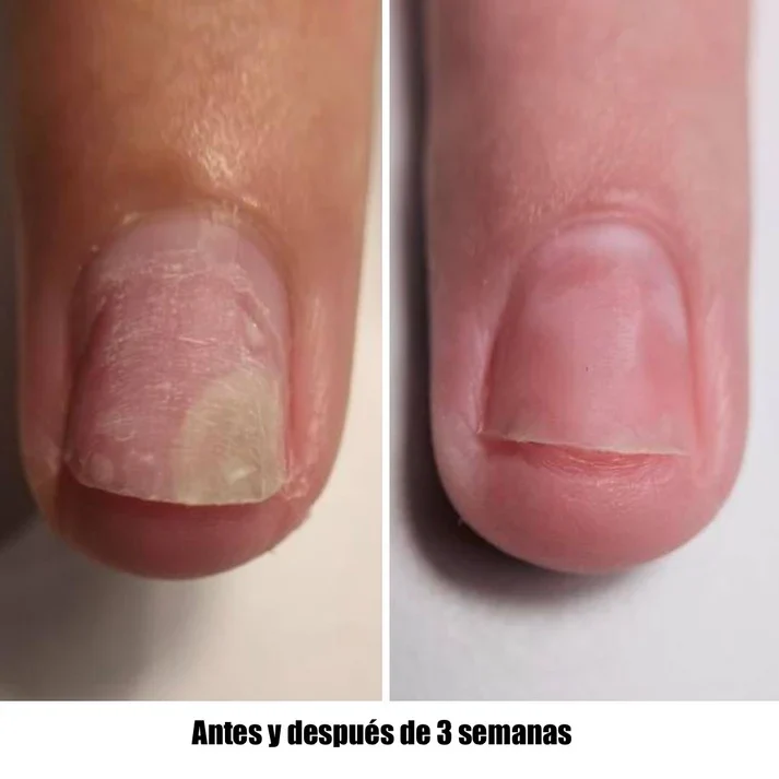 NAILSOFTHEDAY ONISTOP – Aceite regenerador, 8 ml