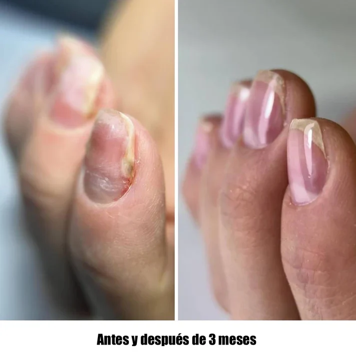 NAILSOFTHEDAY ONISTOP – Aceite regenerador, 8 ml