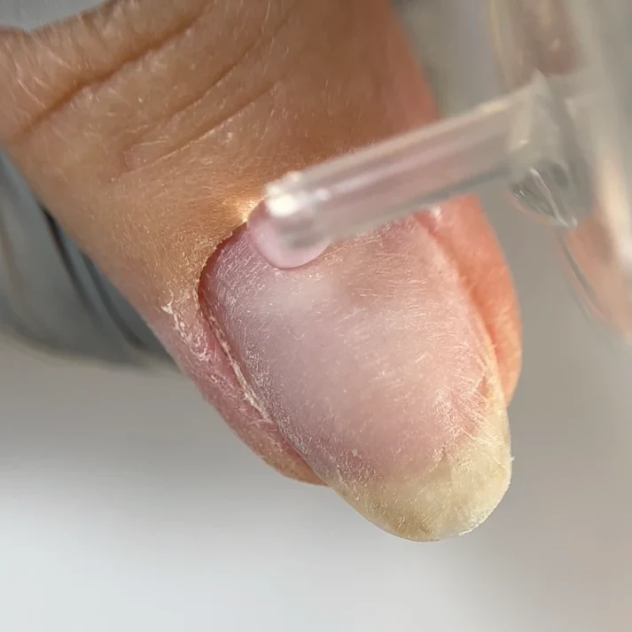 NAILSOFTHEDAY Removedor de Cutículas y Regenerador (con urea), 60 ml